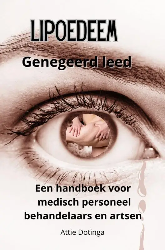 Lipoedeem