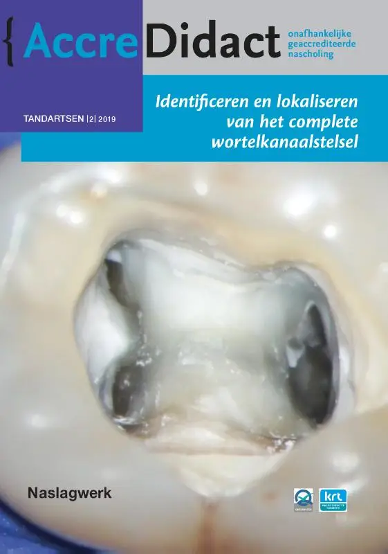 Identificeren en lokaliseren van het complete wortelkanaalstelsel